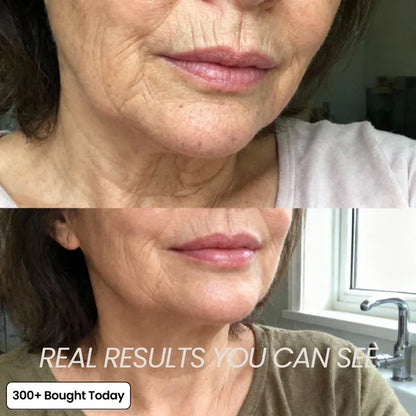 Transform Wrinkles, Fine Lines, And Tired Creases Naturally