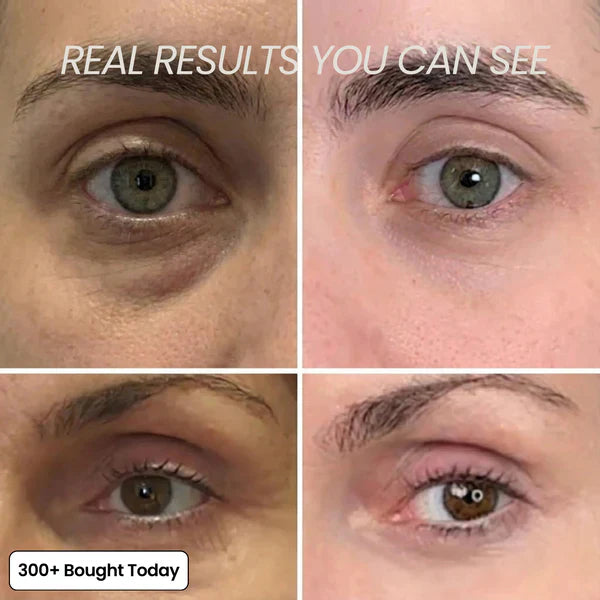 Transform Wrinkles, Fine Lines, And Tired Creases Naturally