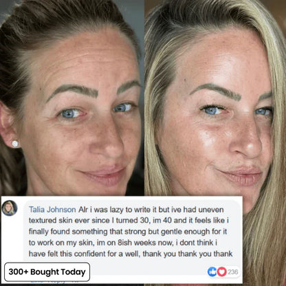 Transform Wrinkles, Fine Lines, And Tired Creases Naturally